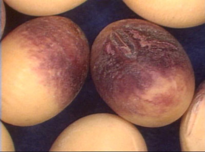 Semi di soia con macchia viola causata da Cercospora