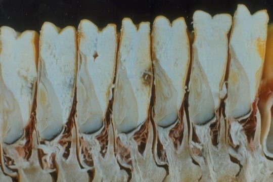 Cross section of kernels following physiological maturity. The black abscission layer is visible at the tip of the kernels.