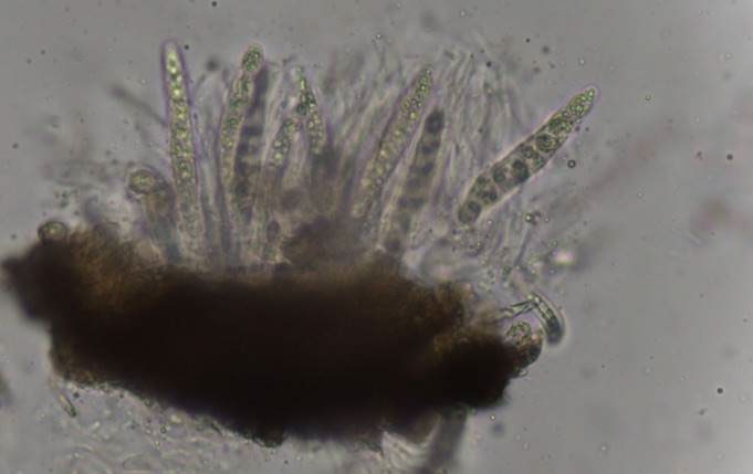 Microscopic view of fungal spores of P. maydis.