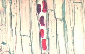 Photo - Lesion nematode eggs in corn root tissue.