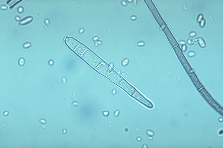 Cercospora zeae-maydis spore