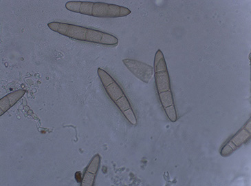 Spores of Exserohilum turcicum under a microscope