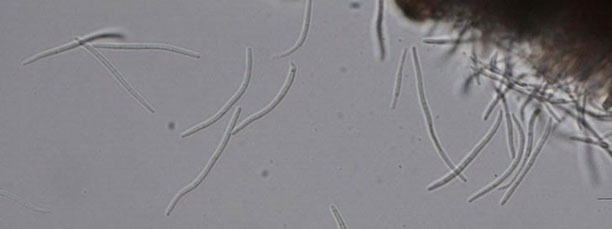 Photo - Asexual spores of Zymoseptoria tritici.